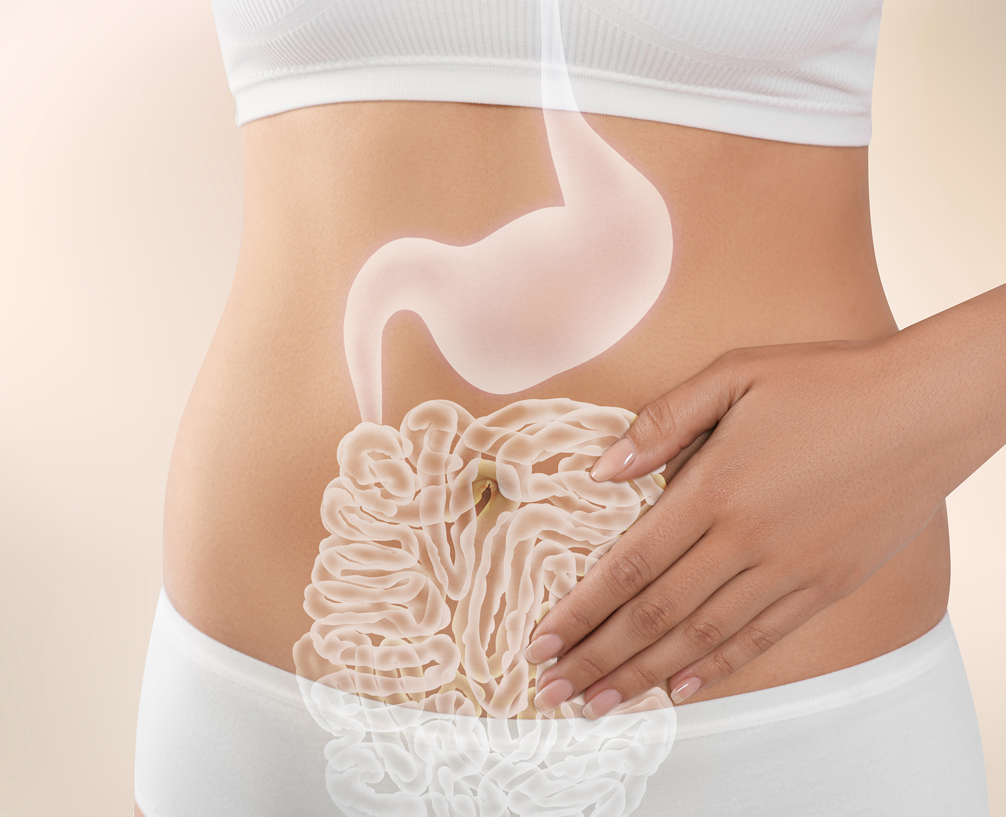 Preventing Diverticulitis Recurrence Tips for Long Term Gut Health